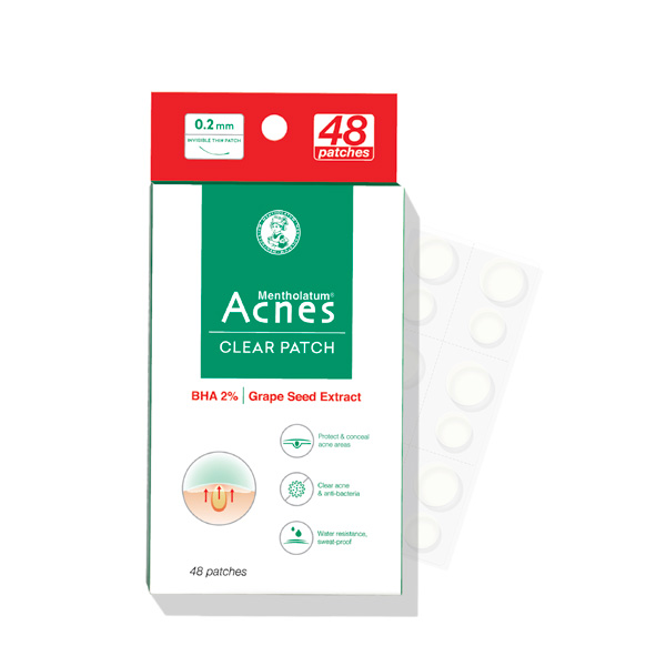 mieng dan mun acnes giup giam mun sung viem 48 mieng